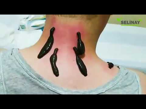Esen Masaj Salonu Esenyurt cilt bakımı